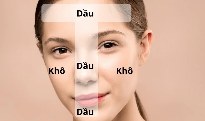 cách chăm sóc da hỗn hợp
