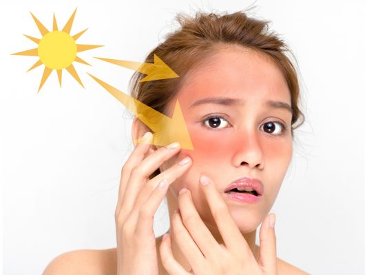 Chăm sóc da từ kem chống nắng